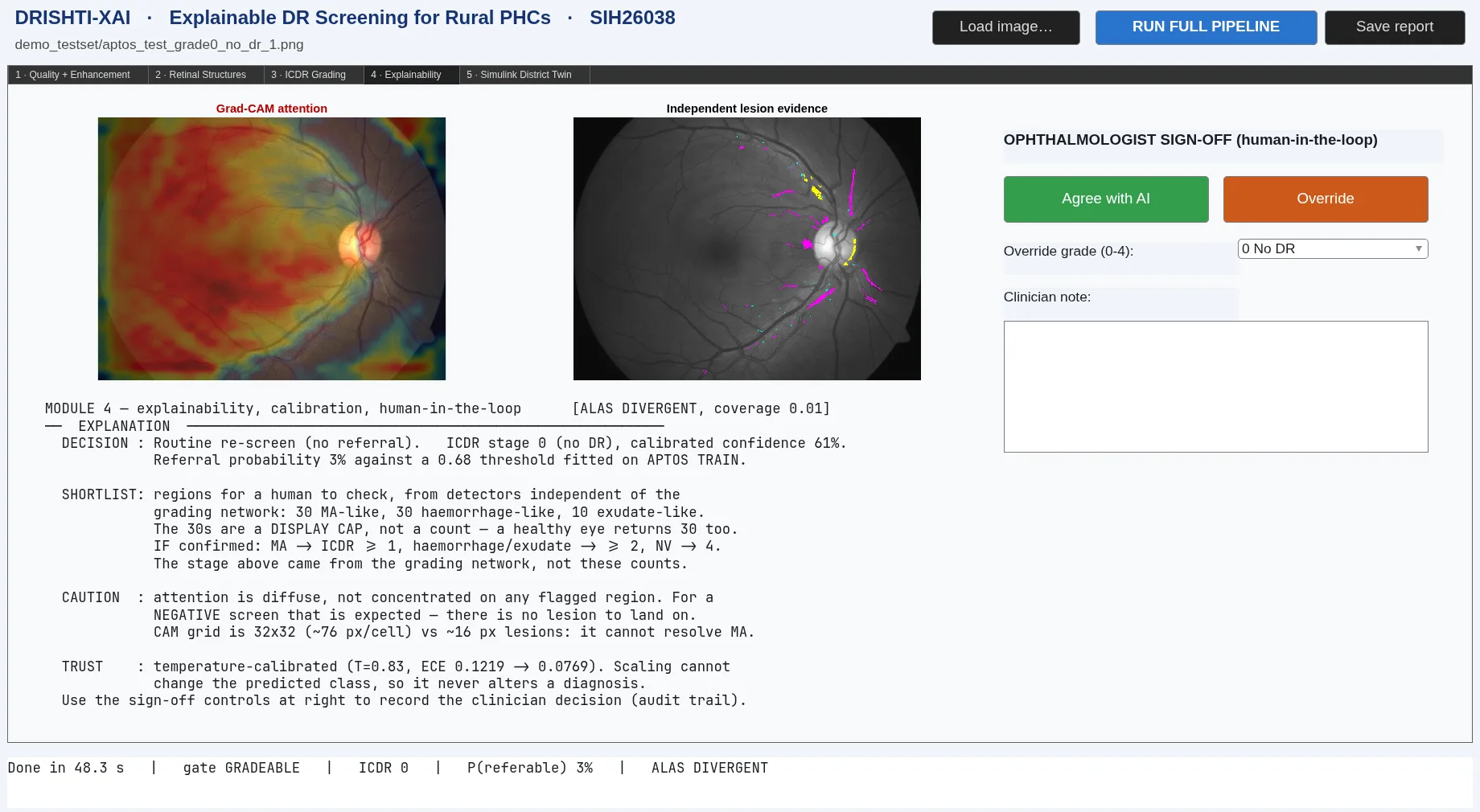 Drishti-XAI's explainability view with Grad-CAM, lesion evidence and clinician review controls